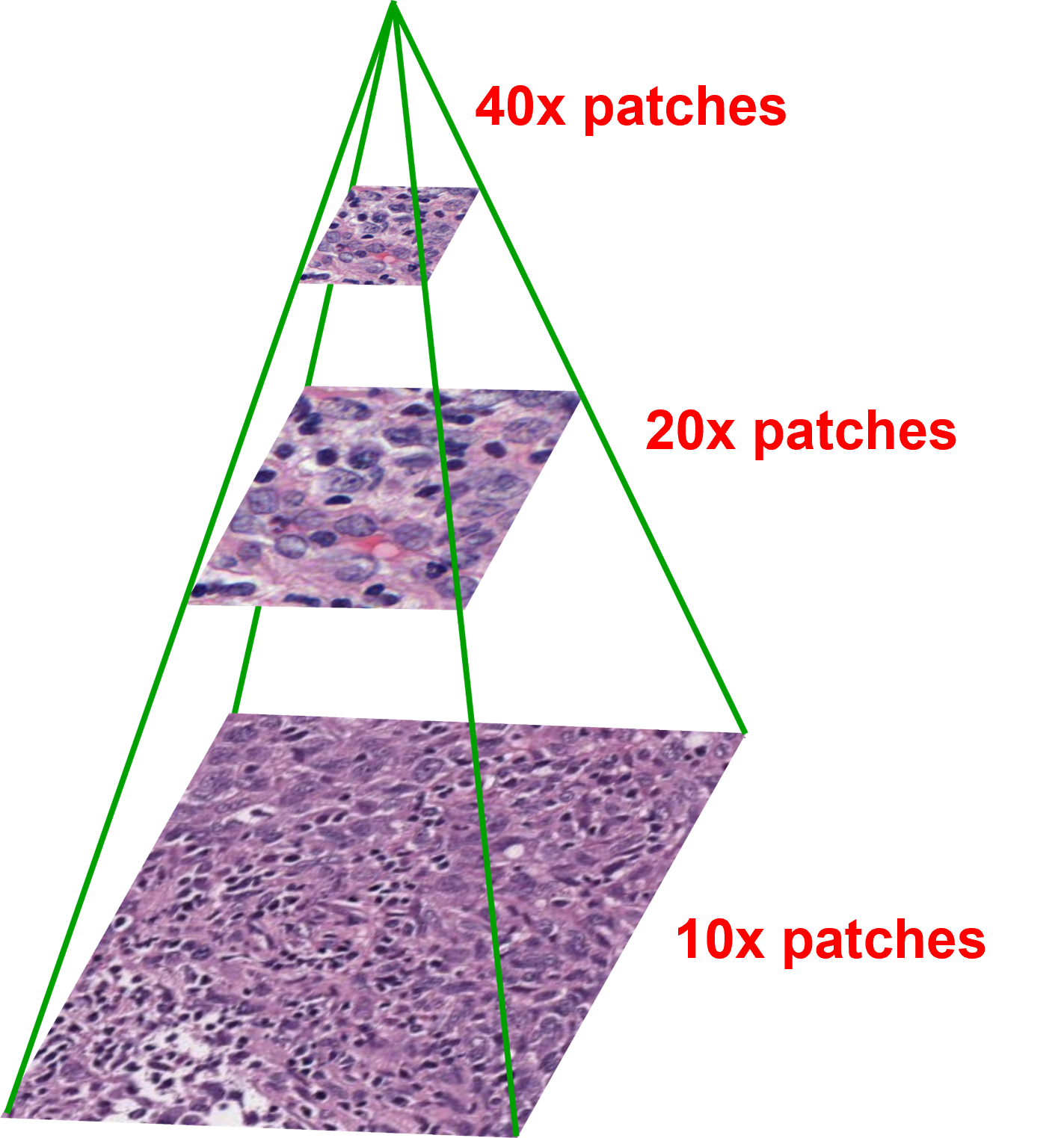 A pyramid representing different resolutions of histopathology slides from top to bottom moving from 10 times, 20 times and 40 times magnification